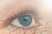 Sécheresse oculaire et chirurgie réfractive