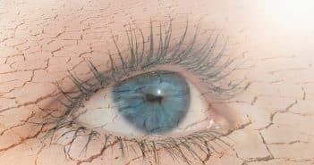 Sécheresse oculaire et chirurgie réfractive