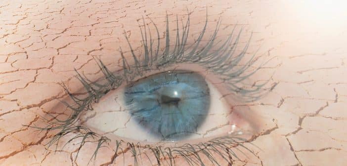 Sécheresse oculaire et chirurgie réfractive