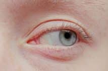 Quoi de neuf dans les pathologies cornéennes ?