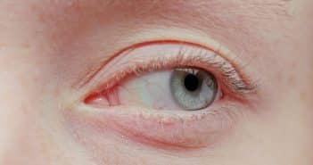Quoi de neuf dans les pathologies cornéennes ?