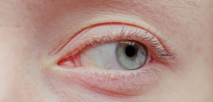 Quoi de neuf dans les pathologies cornéennes ?