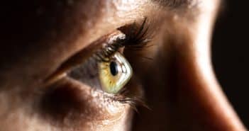 Les segments d’anneaux cornéens intrastromaux allogéniques en chirurgie du kératocône