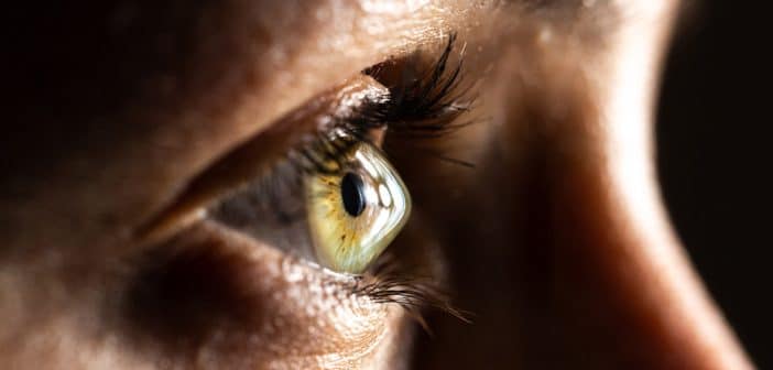 Les segments d’anneaux cornéens intrastromaux allogéniques en chirurgie du kératocône