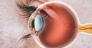 Les lymphomes vitréo-rétiniens primitifs : quelles options thérapeutiques en 2025 ?