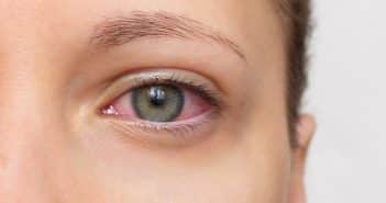 Regards croisés sur les toxicités ophtalmologiques des anticorps conjugués anti-cancéreux (ADC)