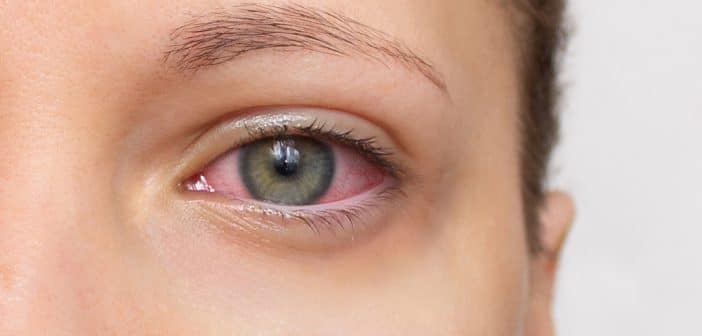 Regards croisés sur les toxicités ophtalmologiques des anticorps conjugués anti-cancéreux (ADC)