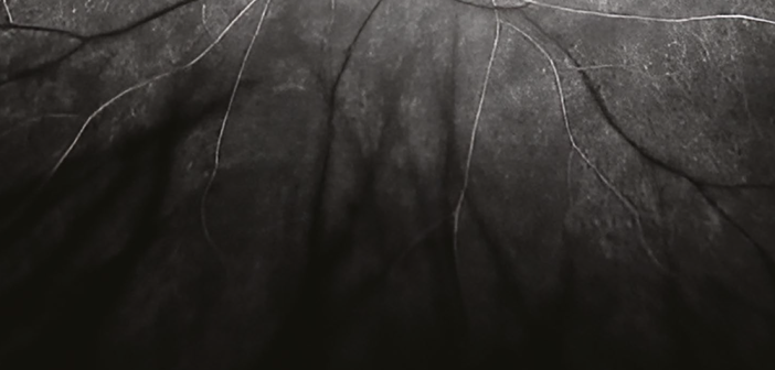 Syphilis et tuberculose : toujours présentes